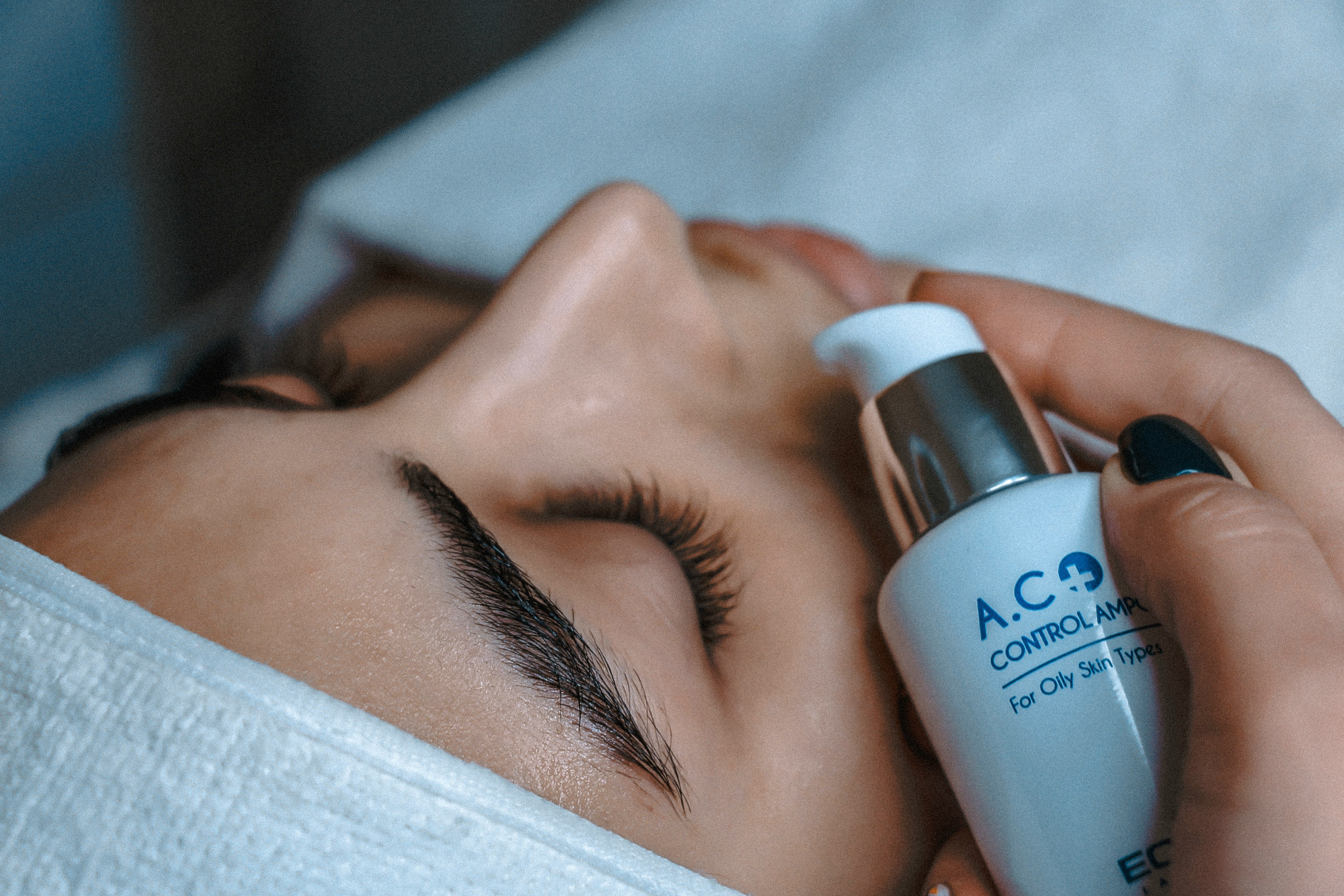 Acne Treatments